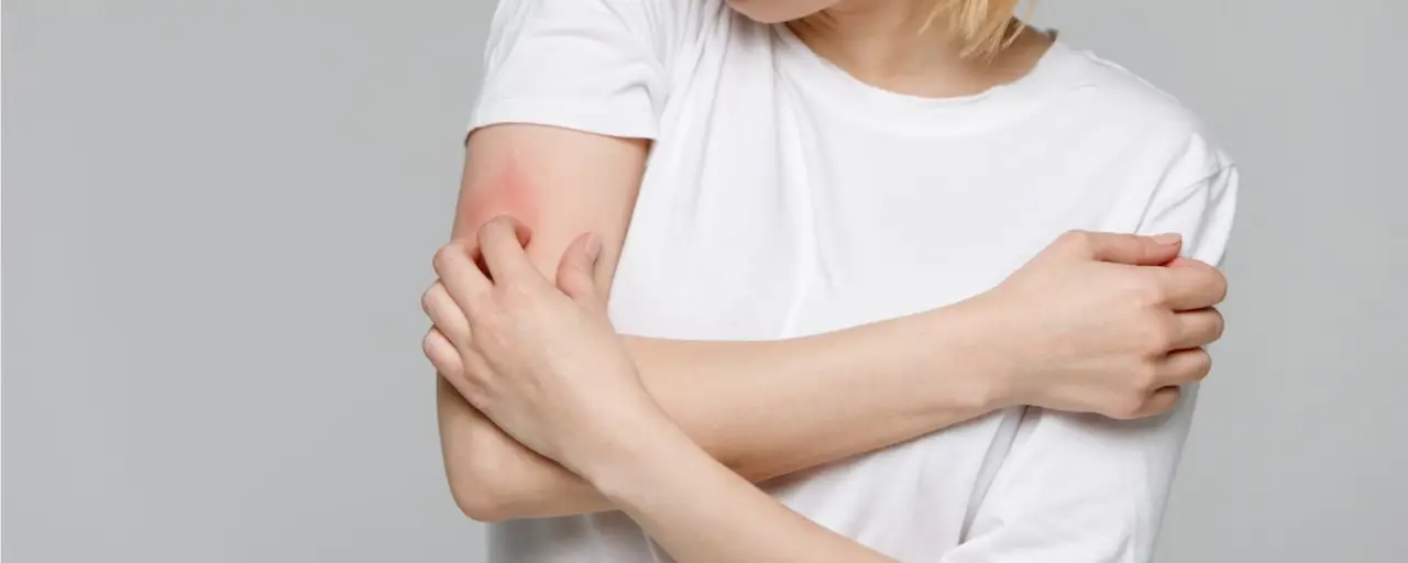 Allergie alimentari: i segnali nascosti che non sai riconoscere